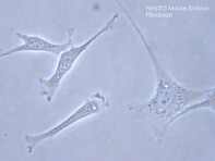 Image of fibroblast cell